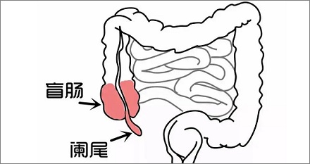 人类为什么要长阑尾?