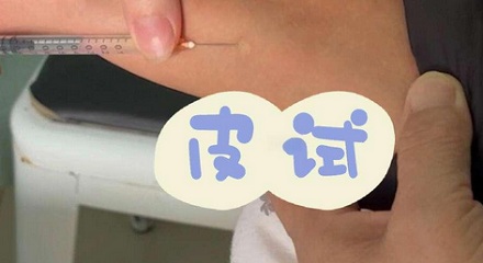 输头孢之前,为啥不用像小时候那样做皮试了?