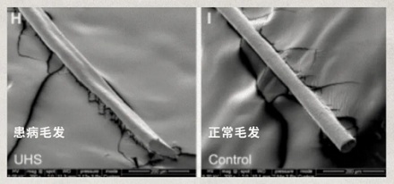 为什么爱因斯坦的头发总是乱糟糟的?