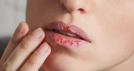 秋冬季节嘴唇易干裂，舔嘴唇有助于保湿吗？