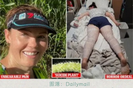 为什么在野外,干万不能用叶子擦屁股?