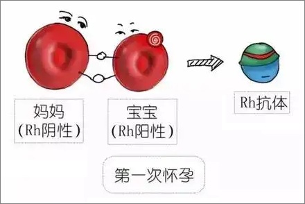 Rh 阴性血的妈妈只能生一个孩子?
