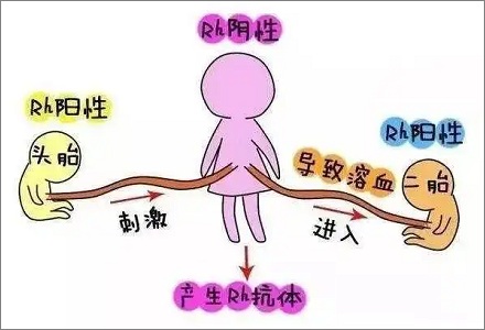 Rh 阴性血的妈妈只能生一个孩子?