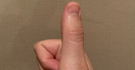 食指无名指都是三节,为什么只有大拇指是两节?
