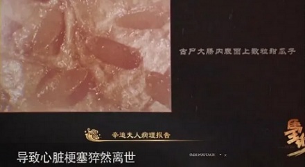 为什么做肠镜前千万不能吃香瓜？