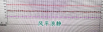 为什么手术室里最怕麻醉医生忽然站起来？