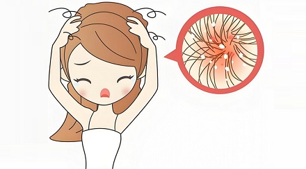 头皮上的黄色小颗粒，到底是啥？