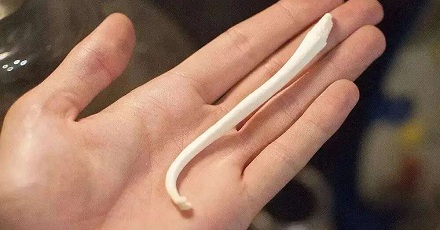 人类为什么不长阴茎骨?