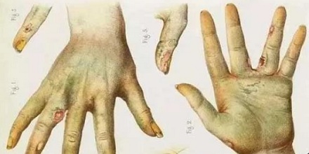 为啥动画和游戏中,所有的毒都是「绿色」的?