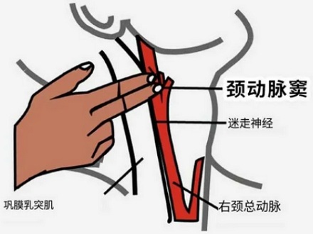 手刀劈脖子就能把人打晕,现实里真能做到吗?