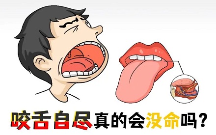 咬舌自尽真的能死吗,是失血死的还是疼死的?