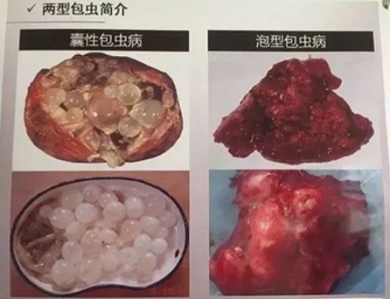为什么冰川水这么恐怖?喝了就会死?