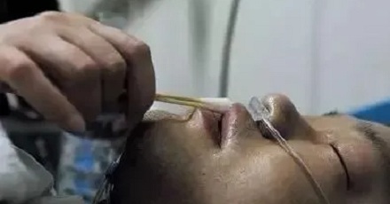 为什么出车祸后,感觉口渴千万不能喝水?
