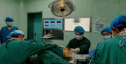 为什么被打到腿部大动脉会死，但是腿炸断了反而能活？