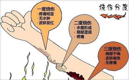 烫伤后的水泡究竟是什么?