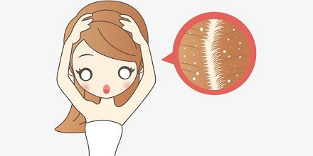 我们不能没有头皮屑？